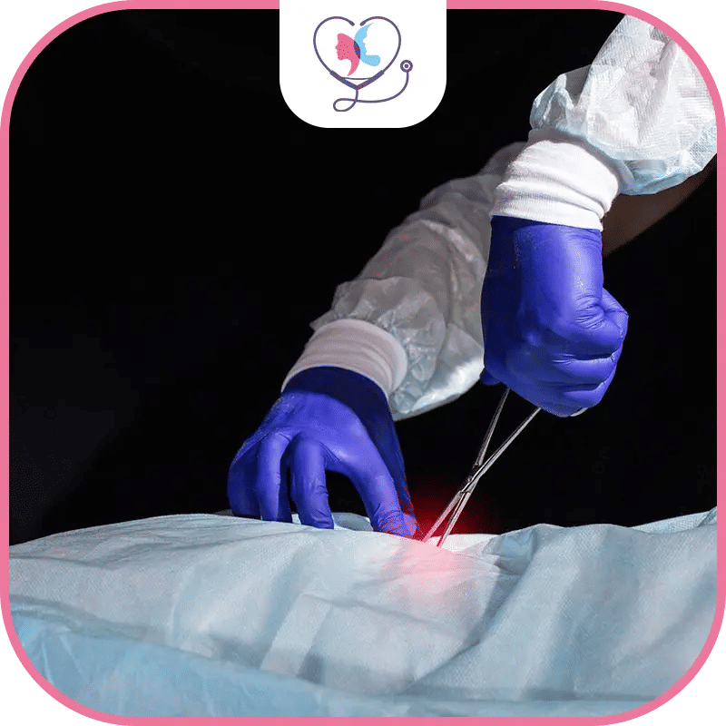 تكلفة جراحة الجنف في تركيا