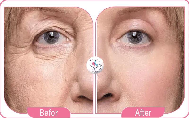 التعرف على تركيا لاكشري كلينك