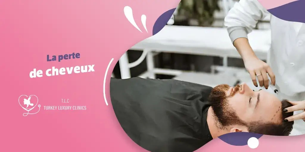 Perte de cheveux