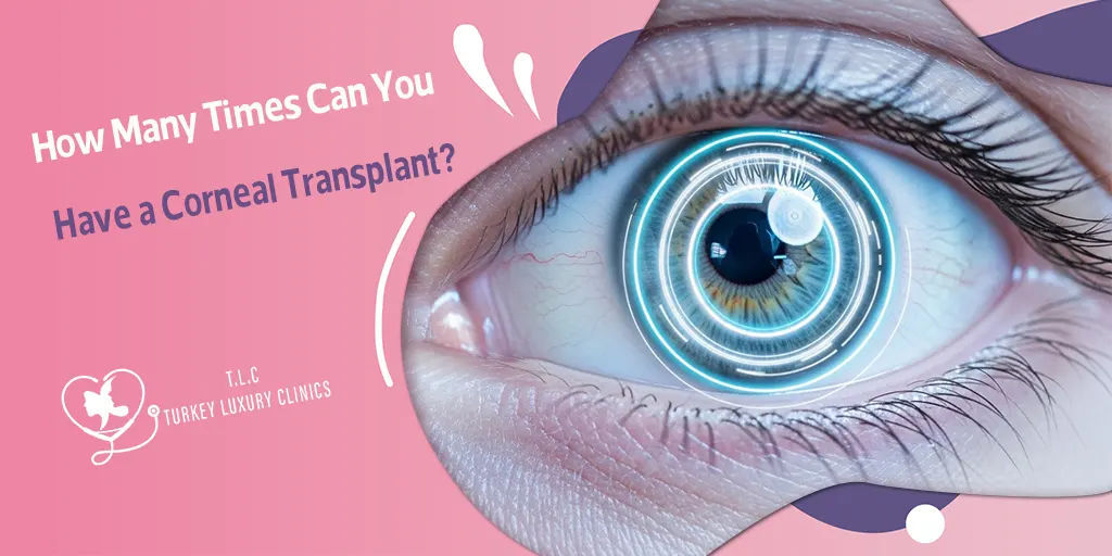 ¿Cuántas veces se puede hacer un trasplante de córnea?