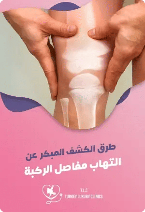 طرق الكشف المبكر عن التهاب مفاصل الركبةfeatured image