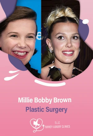 Millie Bobby Brown Plastic Surgery: Rumors vs. Reality with Photos