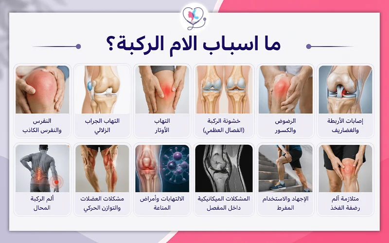 ما اسباب الام الركبة؟