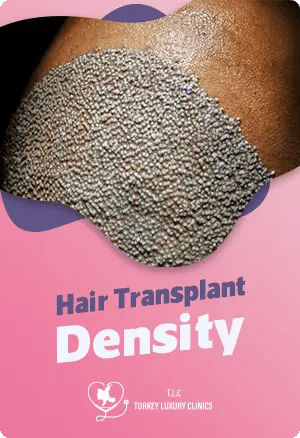 Hair Transplant Density