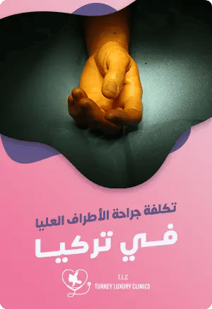 تكلفة جراحة اليد في تركياfeatured image