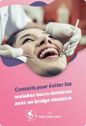 Conseils pour éviter les maladies bucco dentaires avec un bridge dentaire