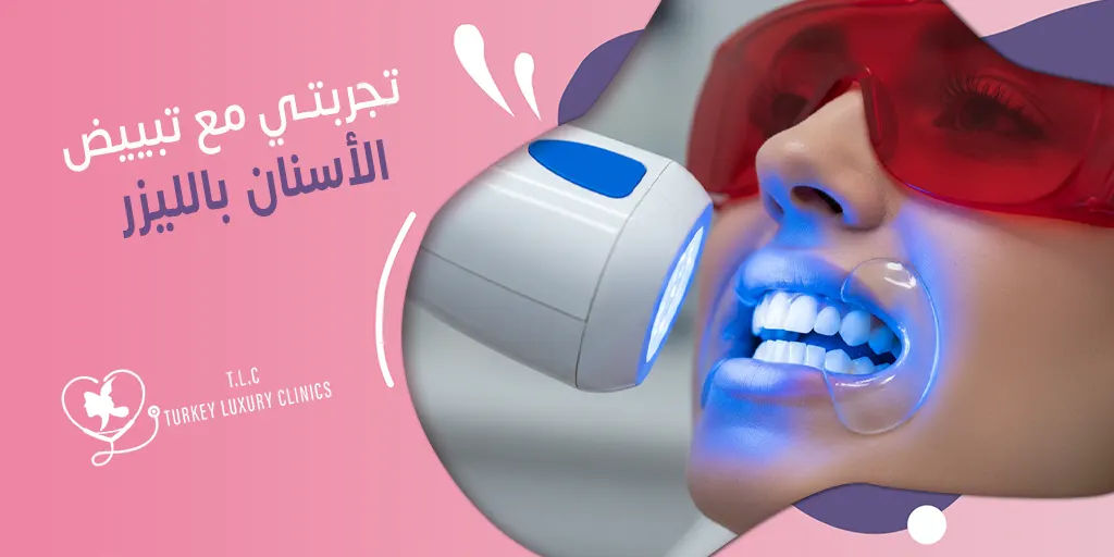 تجربتي مع تبييض الأسنان بالليزر: نتائج حقيقية بالصور