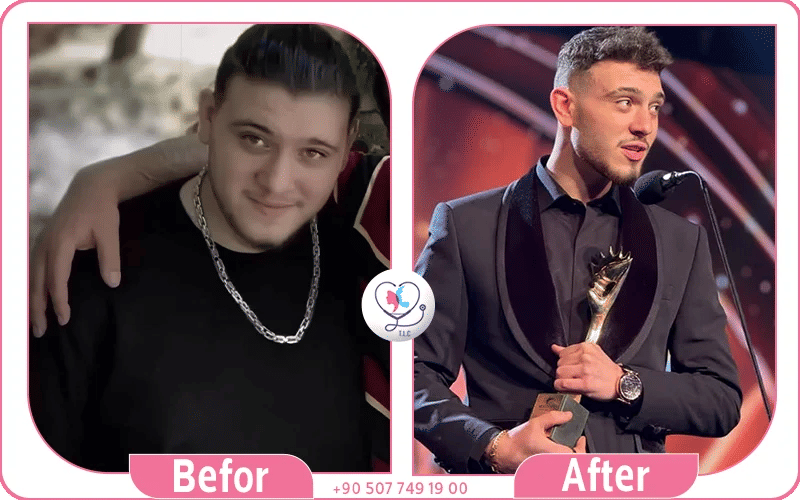 صور الشامي قبل وبعد