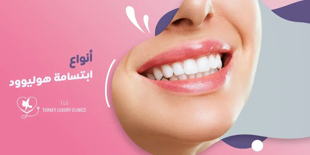 تعرف على أنواع ابتسامة هوليود المختلفة: دليل شامل