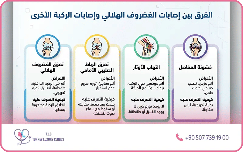 ما الفرق بين إصابة غضروف الركبة الهلالي والإصابات الأخرى؟