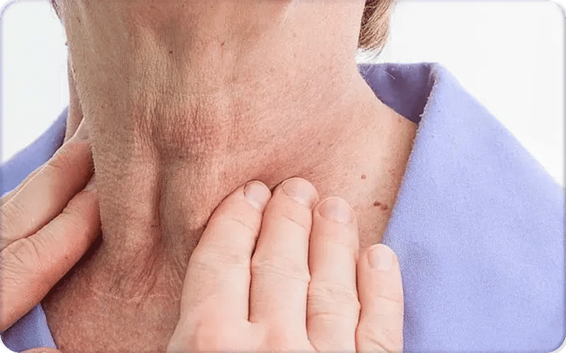 تشخيص تضخم الغدة الدرقية