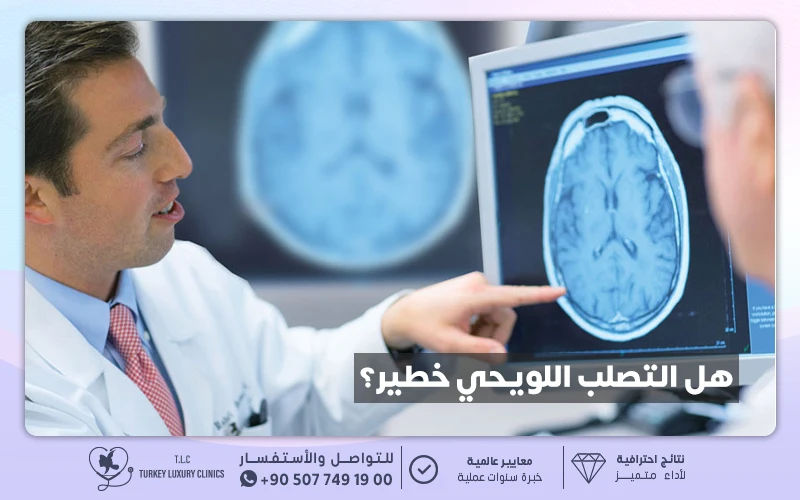 هل التصلب اللويحي خطير؟