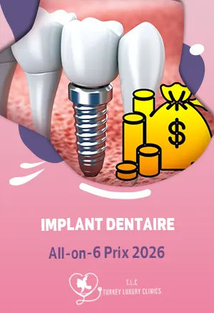 Prix implant dentaire complet 2026 