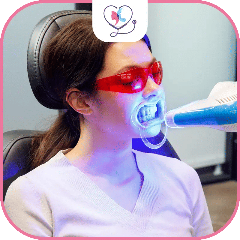 المرشحون لتبييض الأسنان بالليزر