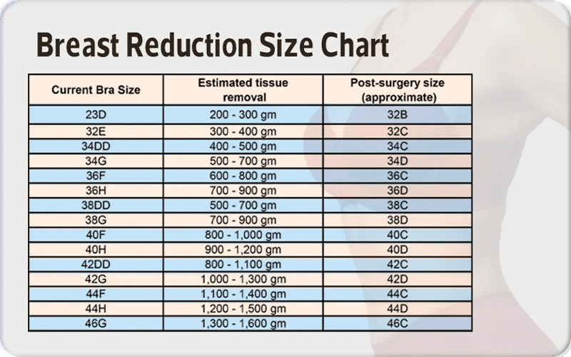 Breast Reduction Size Chart