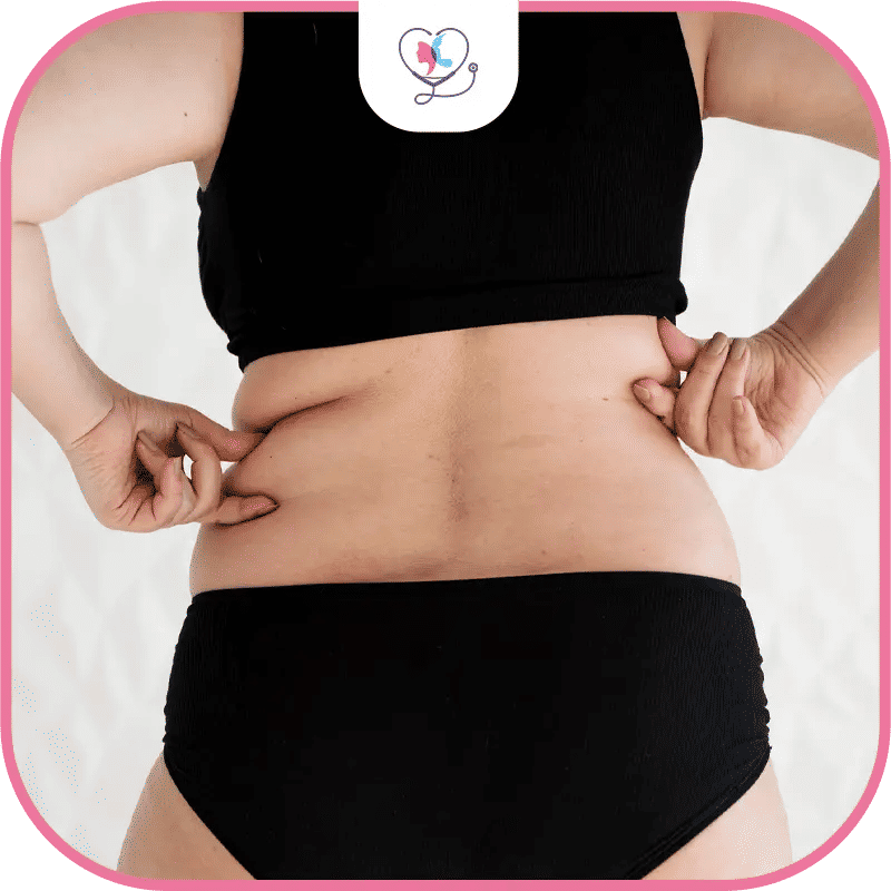 شفط دهون الظهر