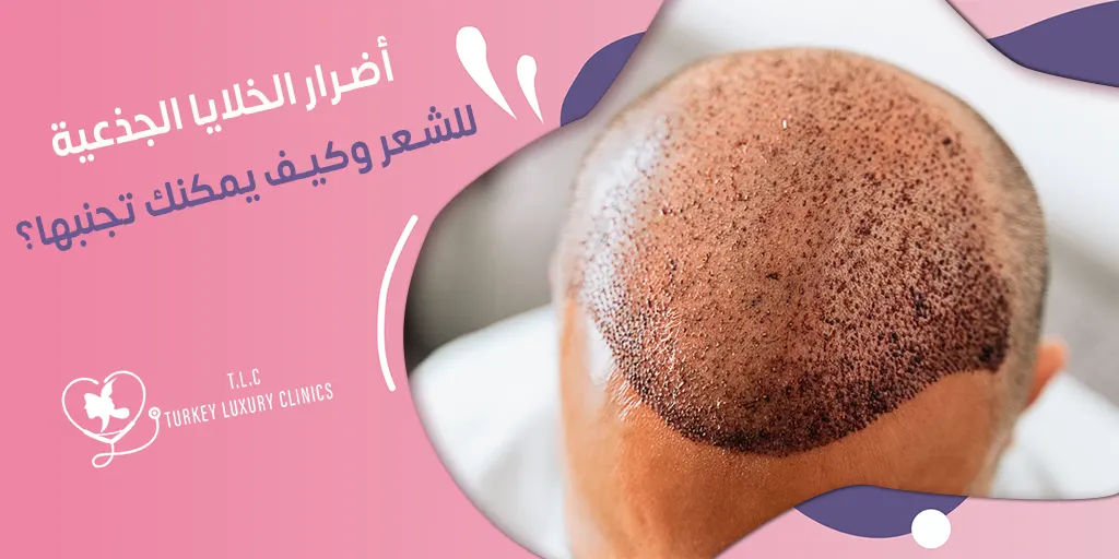 أضرار الخلايا الجذعية للشعر: ماهي؟ مع نصائح للوقاية منها