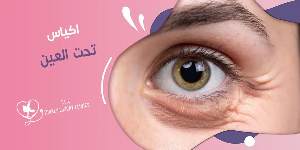 اكياس تحت العين: الأسباب وطرق العلاج الفعالة
