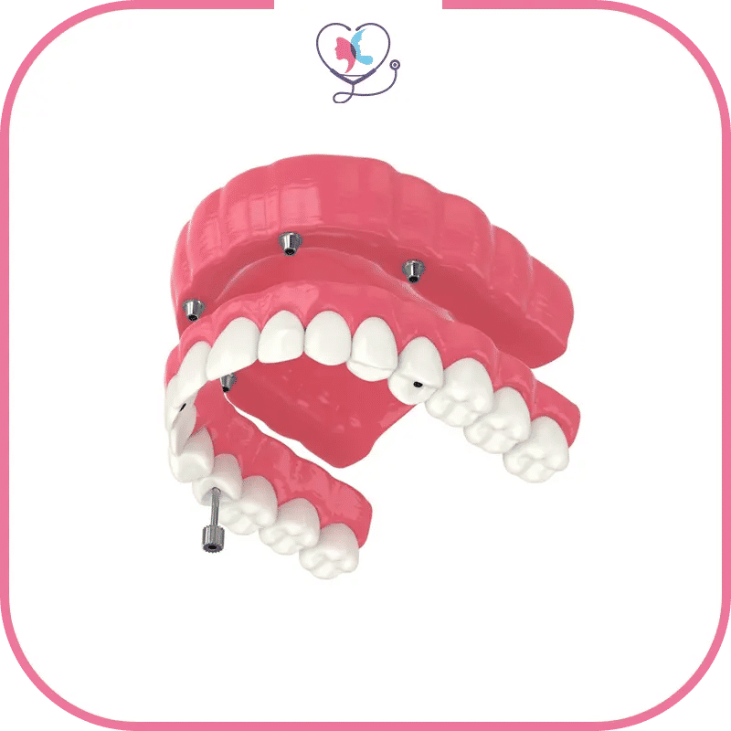 The process of Getting Dentures