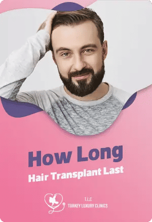 How Long Hair Transplant Last
