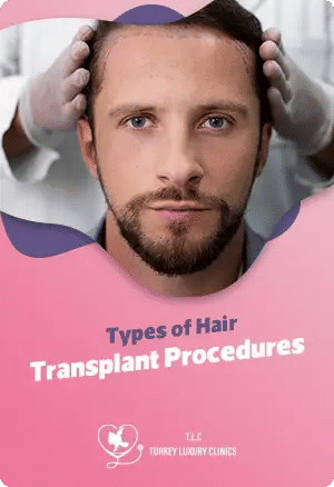 Types of Hair Transplant Proceduresfeatured image
