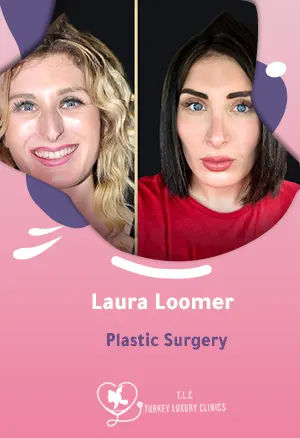 Laura Loomer Plastic Surgery: Nose Job, Lip Fillers & Transformation
