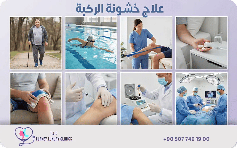 ما هو علاج خشونة الركبة؟