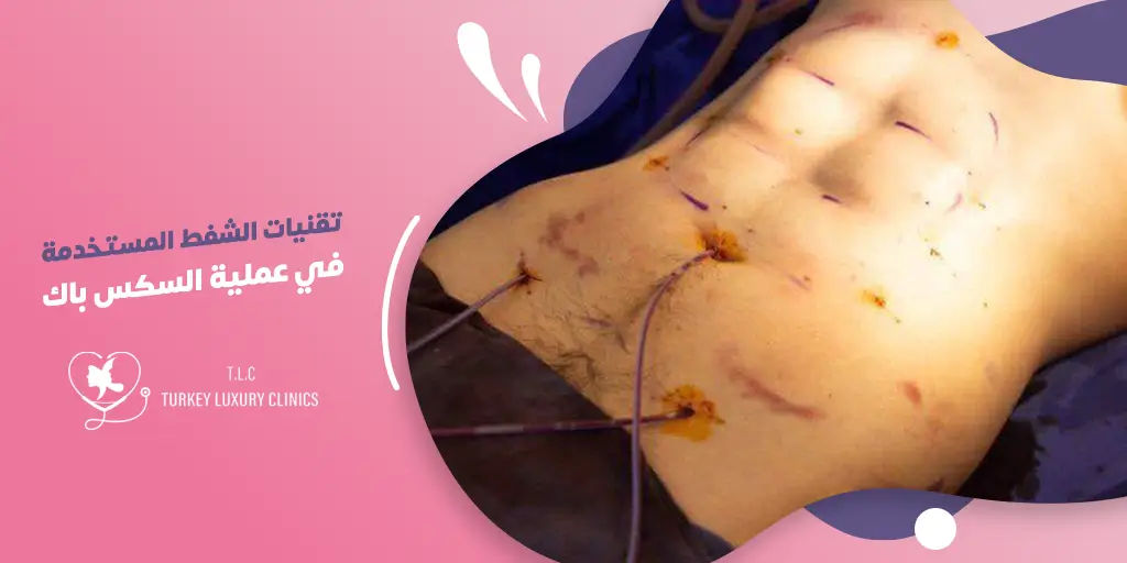 ما هي تقنيات الشفط المستخدمة في عملية Six-Pack؟