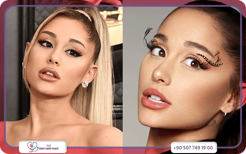 مناطق تشكيل ابتسامة هوليود أسنان الأرنب مناطق تشكيل ابتسامة هوليود أسنان الأرنب