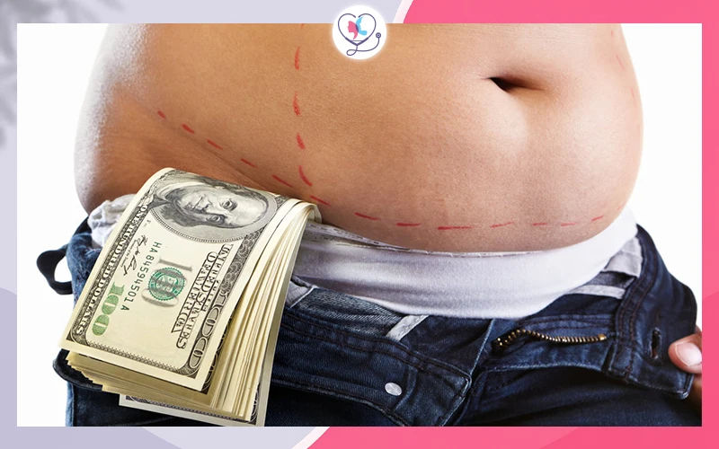 Gastric Sleeve Cost Without Insurance in the U.S.
