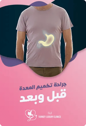 نتائج تكميم المعدة قبل وبعد: صور حقيقية ونتائج صحية