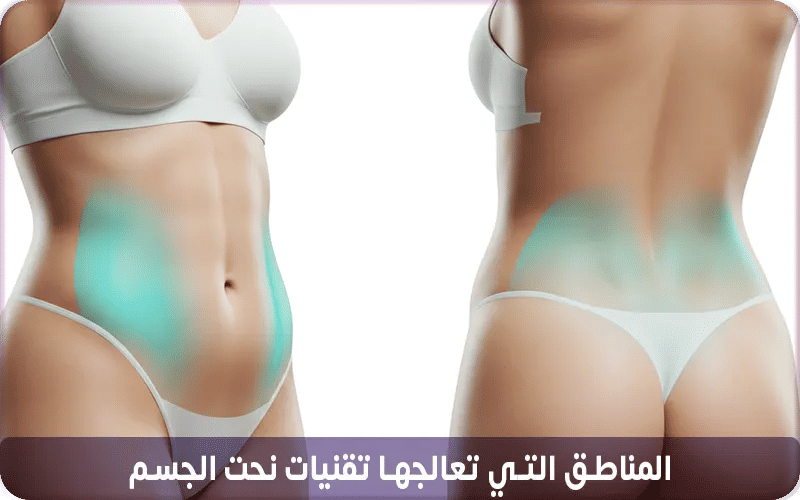 ما هي المناطق التي تعالجها تقنيات نحت الجسم غير الجراحية؟