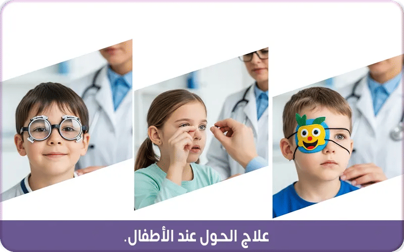 علاج الحول عند الأطفال