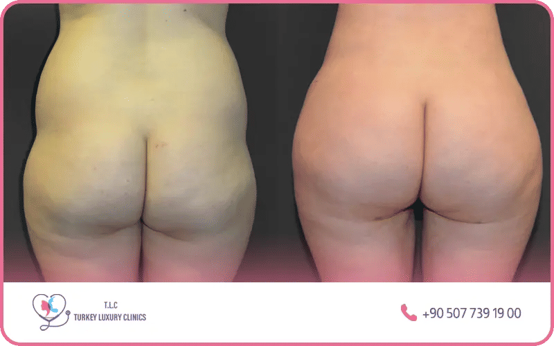 résultats naturels et harmonieux résultats naturels et harmonieux