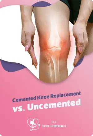 Cemented Knee Replacement vs. Uncementedfeatured image