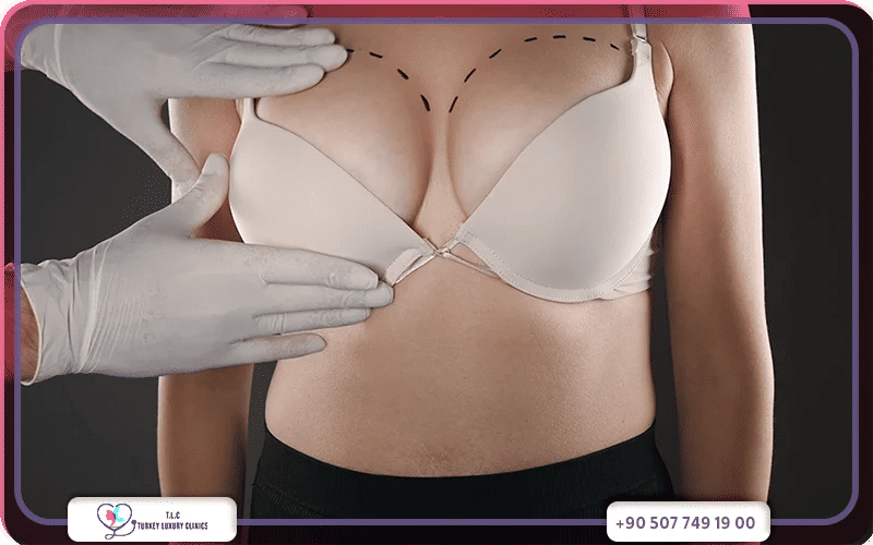 Best Hospitals for Breast Lift in Turkey