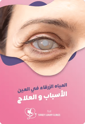 علاج الجلوكوما (الزرق) في تركيا: الأسباب، الأعراض والعلاجfeatured image