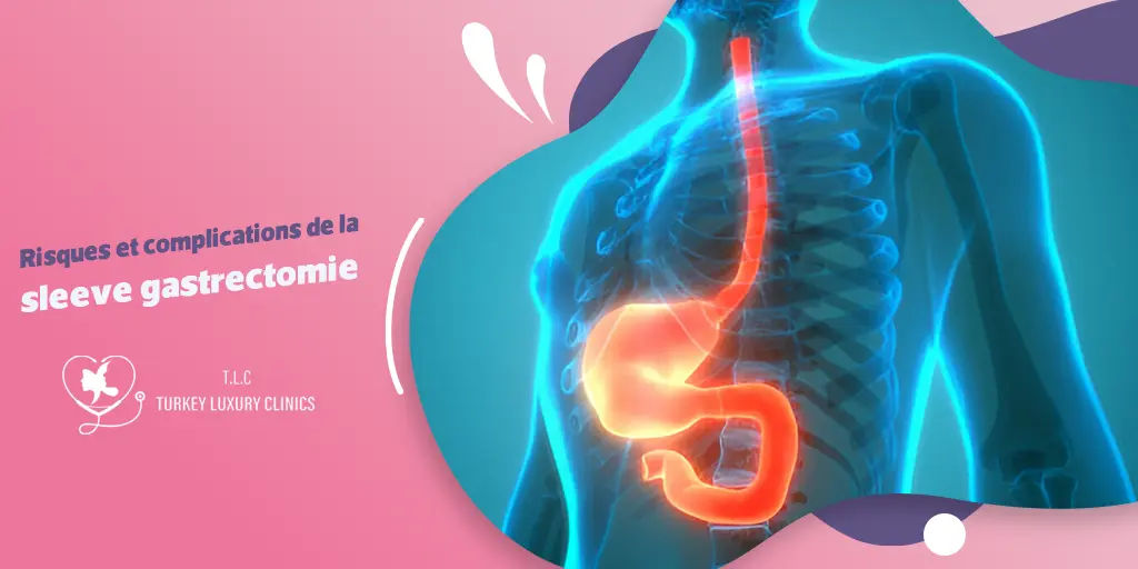 Risques et complications de la sleeve gastrectomie
