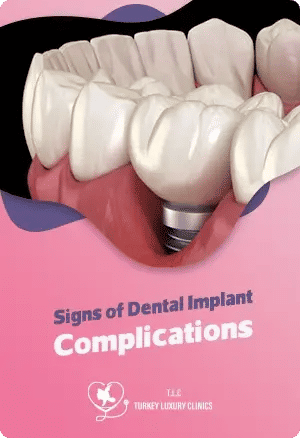 Signs of Dental Implant Complications
