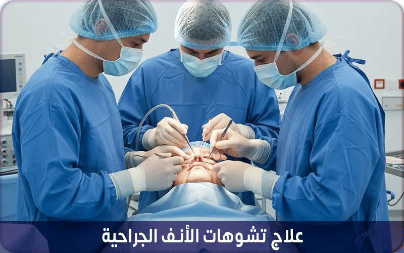 علاج تشوهات الأنف الجراحية