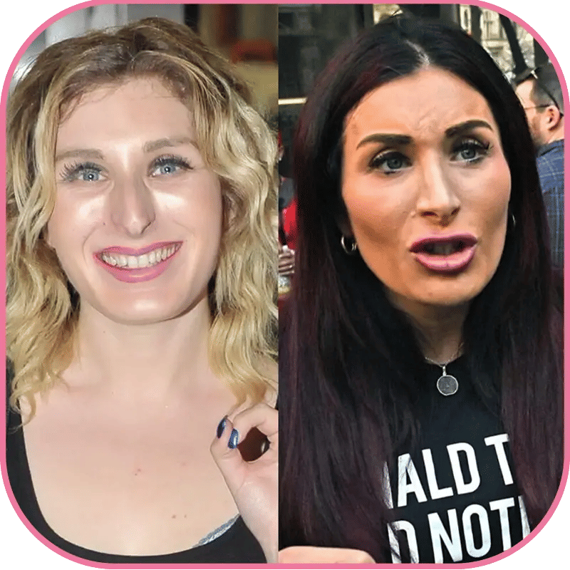Laura Loomer Plastic Surgery: The Truth Behind the Rumors