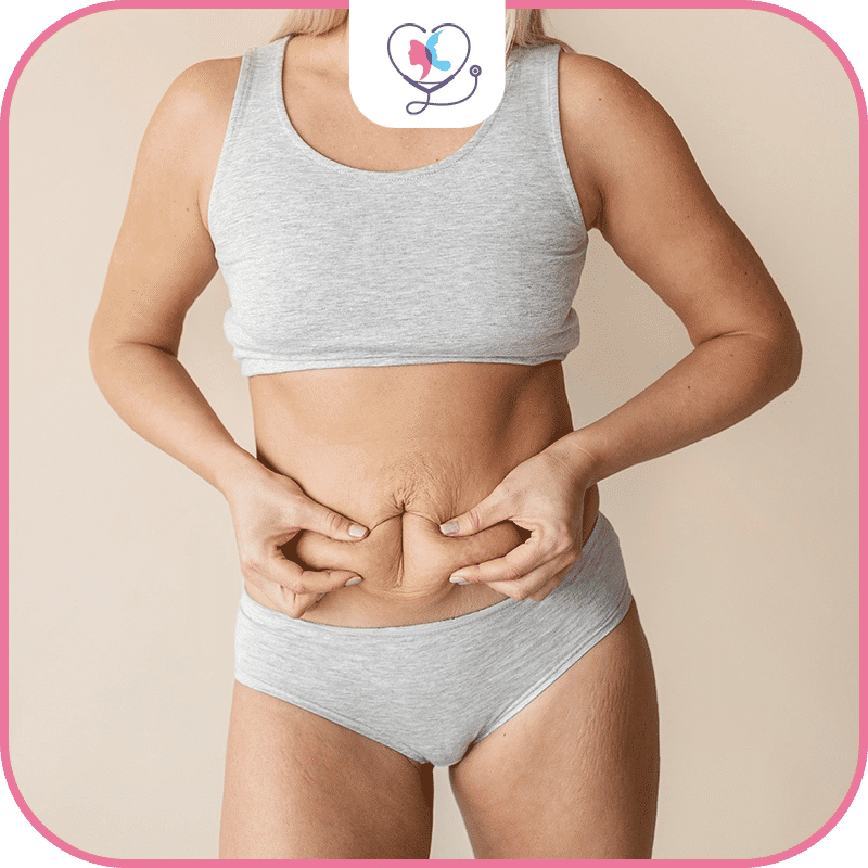 liposuccion tumescente paris -oedeme apres liposuccion- liposuccion tumescente montpellier- liposuccion tumescente lipoedeme