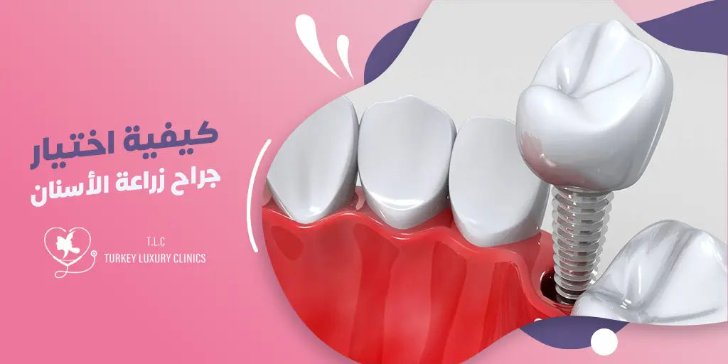 كيفية اختيار أفضل دكتور زراعة الأسنان في تركيا