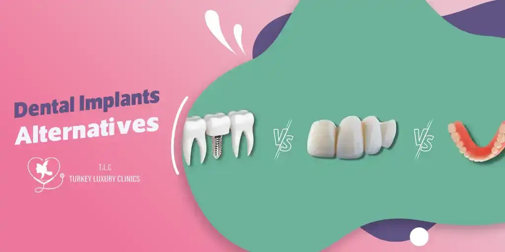 Dental Implant Alternatives: Bridges, Dentures & More