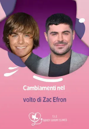 Zac Efrons Gesichtstransformation: Vorher & Nachher