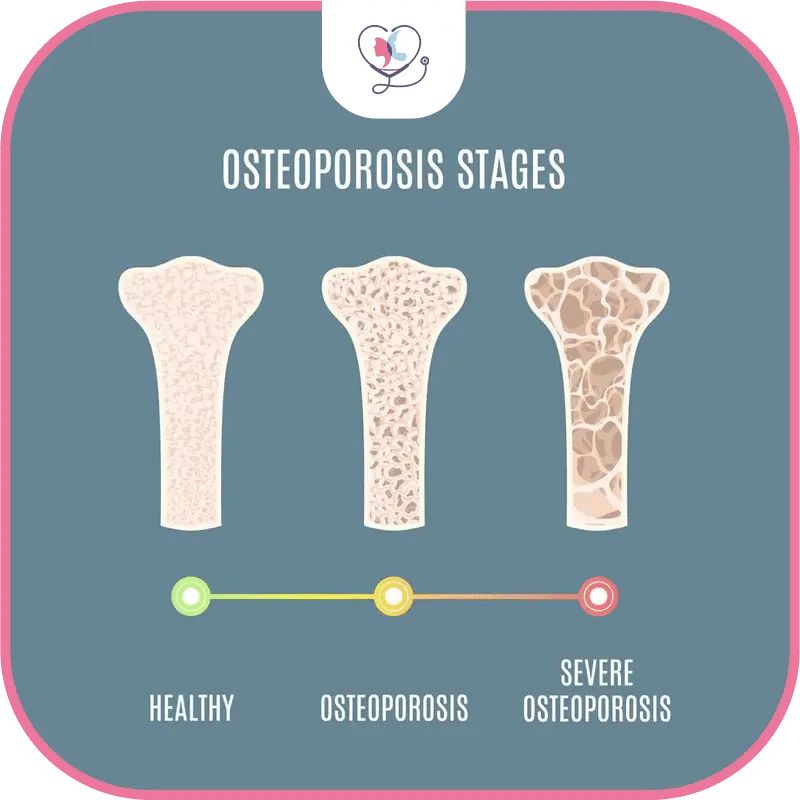 What is Osteoporosis?