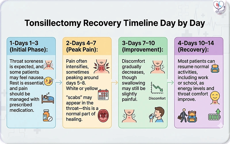 Tonsillectomy Recovery Time