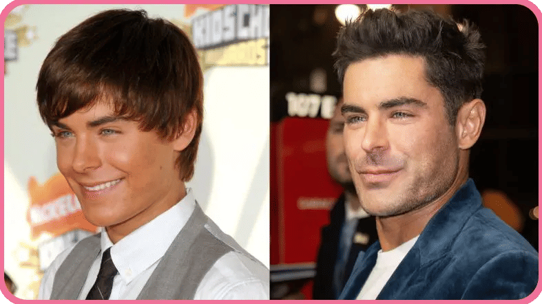 Zac Efron Face Changes