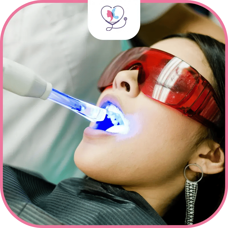 ما هي تكلفة تبييض الاسنان في تركيا؟