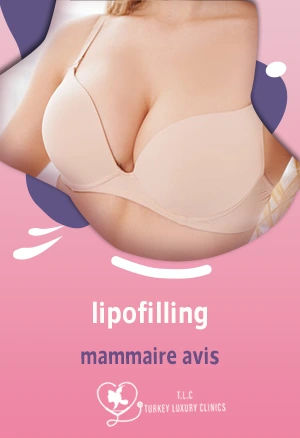 lipofilling mammaire avis